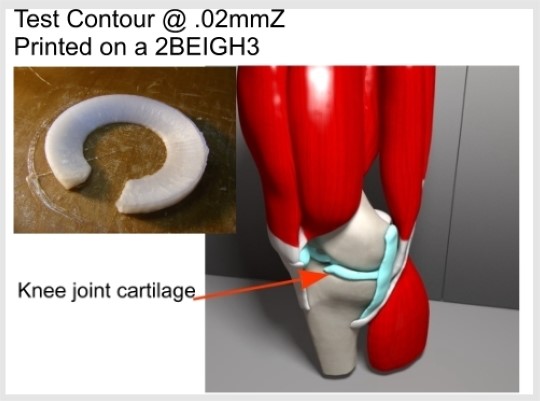 the knee joint is an example of a
