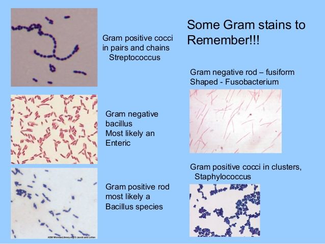 gram negative bacteria example species